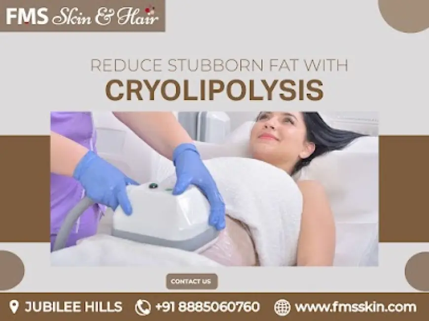 Post-Holiday Blues? Freeze Away the Festive Weight with Cryolipolysis