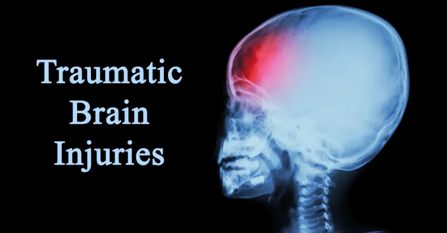 Emergency Care for Traumatic Brain Injury in Hyderabad: What You Need to Know