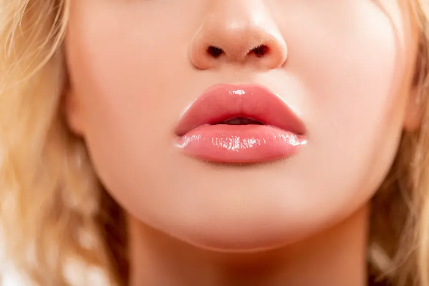 The Truth About Lip Filler Injections in Dubai: What You Need to Know Before Getting Them