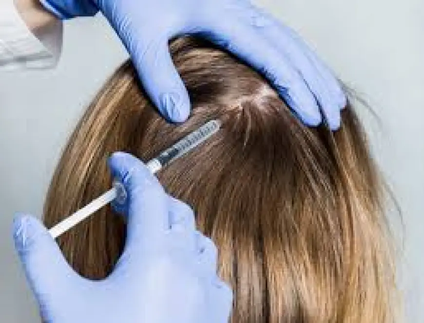 Exosome Therapy for Hair Loss: A Revolutionary Treatment for Hair Regrowth