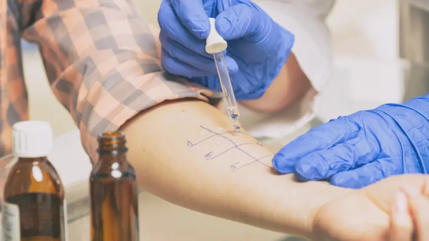 Allergy Testing 101: What You Need to Know Before Getting Tested