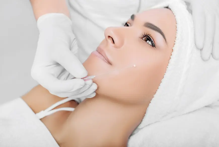 How to Improve Skin Elasticity with Thread Lift Treatment?