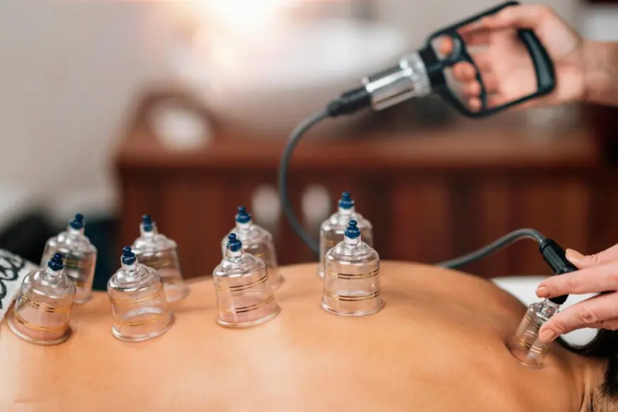 Does cupping remove pain?