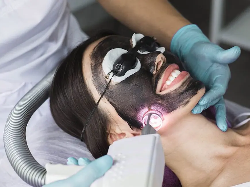 Laser Carbon Peel in Dubai: The Future of Skin Rejuvenation