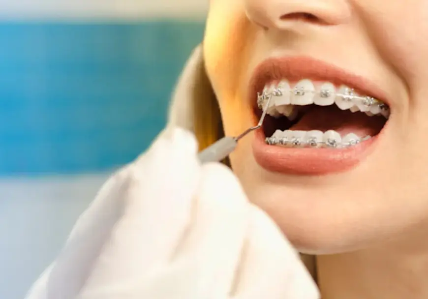 The Hidden Benefits of Early Orthodontic Treatment