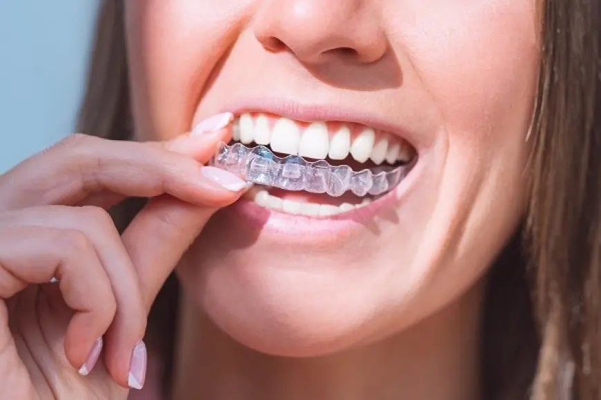 5 Reasons Invisalign Is More Comfortable Than Braces