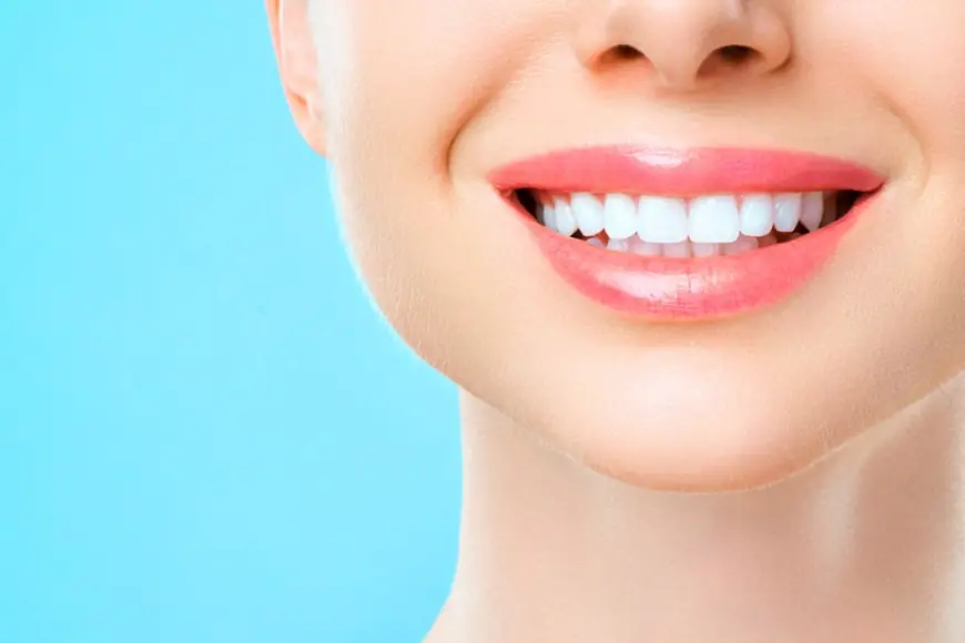 From Chipped Teeth to Perfect Smiles: The Magic of Cosmetic Bonding