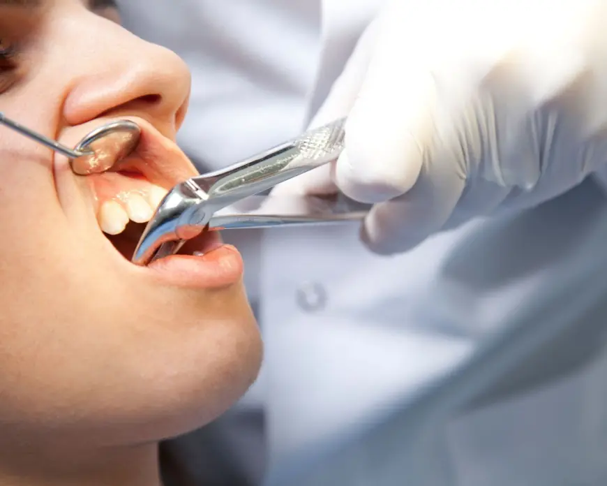 What to Do if Your Tooth Extraction Site Becomes Infected