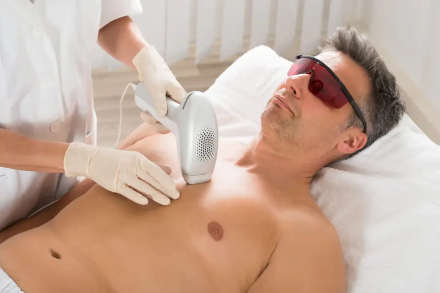 Can You Achieve Permanent Male Hair Reduction with Laser Treatment?