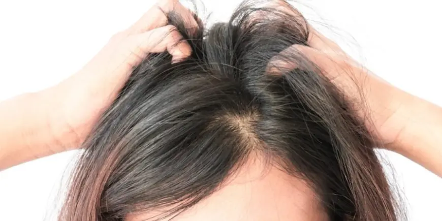 Finasteride: An Effective Option for Hair Loss Management