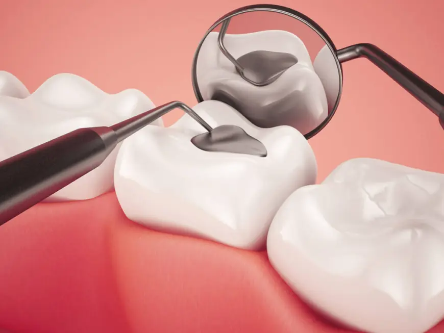 How Composite Fillings Can Help Restore Your Confidence