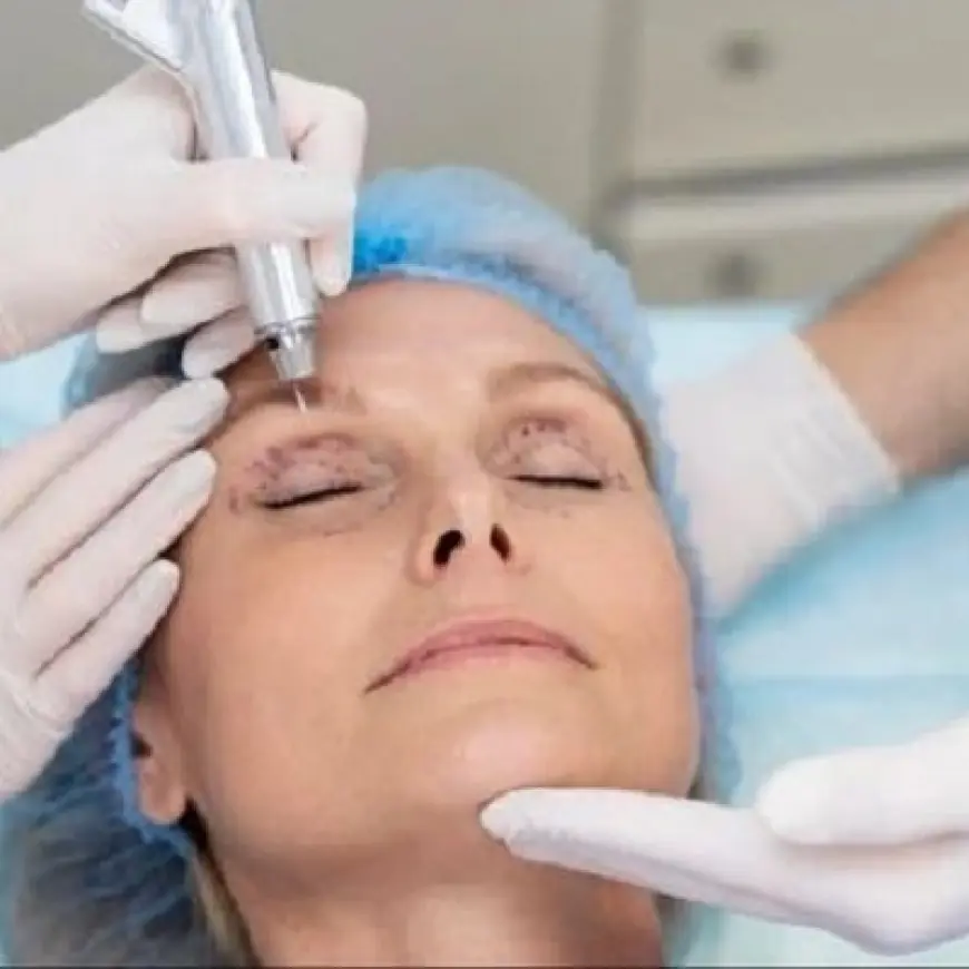 Combining Blepharoplasty with Other Facial Surgeries: What You Need to Know