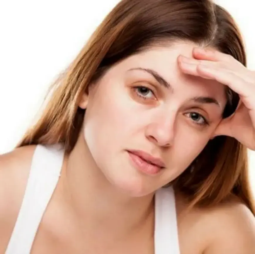 How to Get Rid of Dark Circles in Islamabad – Expert Advice