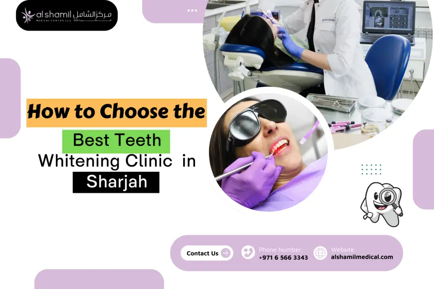 How to Choose the Best Teeth Whitening Clinic in Sharjah