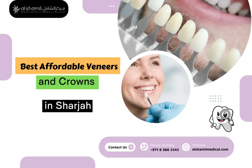 Best Affordable Veneers and Crowns in Sharjah