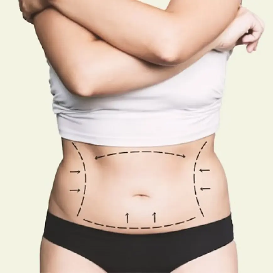 Fat Transfer for Body Contouring: Redefining Your Silhouette