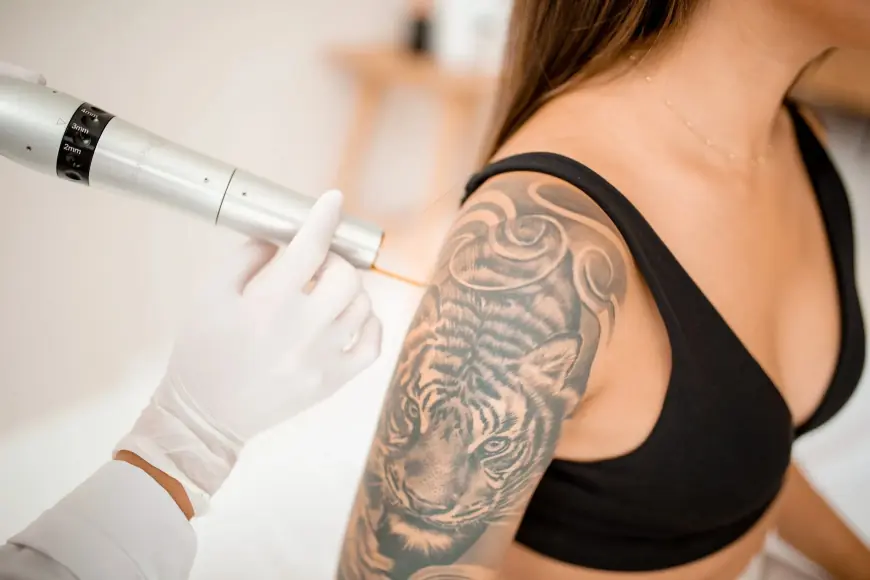 Revive Your Skin with Laser Tattoo Removal in Dubai