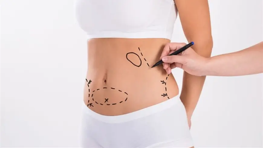 Say Goodbye to Flabby Arms with Arm Liposuction in Dubai