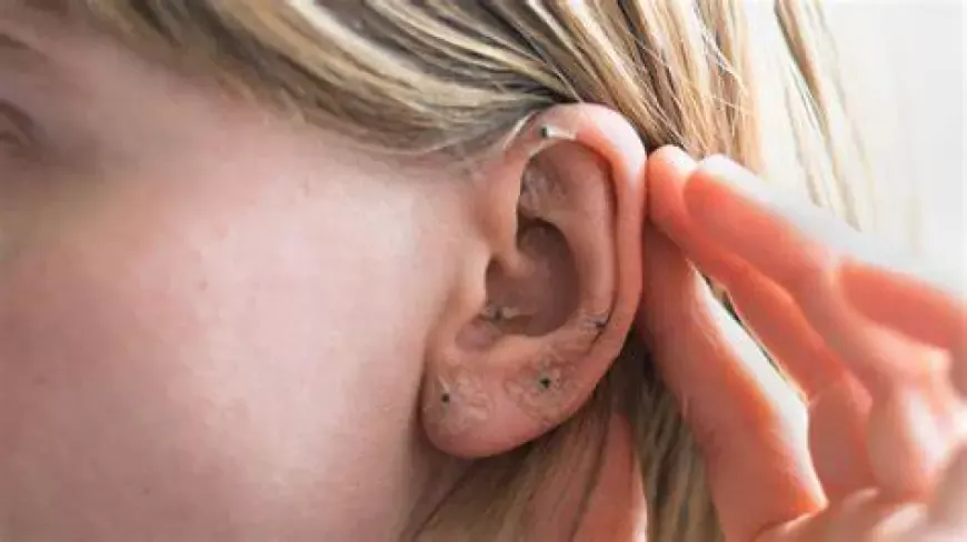 When Should You Consider Ear Acupuncture for Better Health?