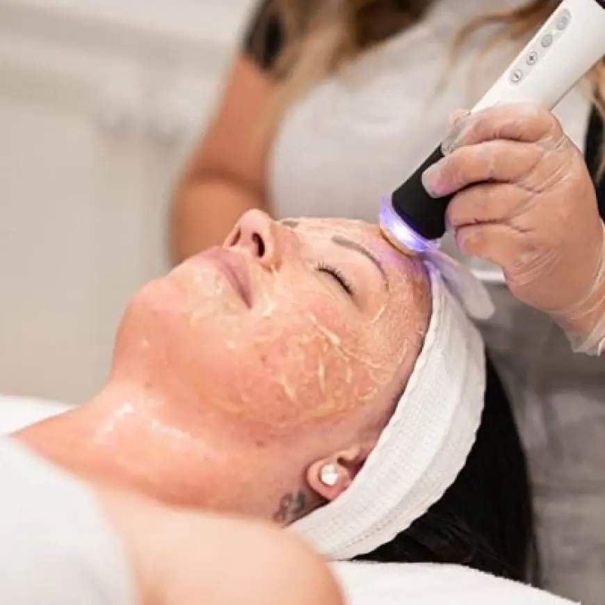 The Power of CO2 in OxyGeneo Facials: How It Rejuvenates Skin