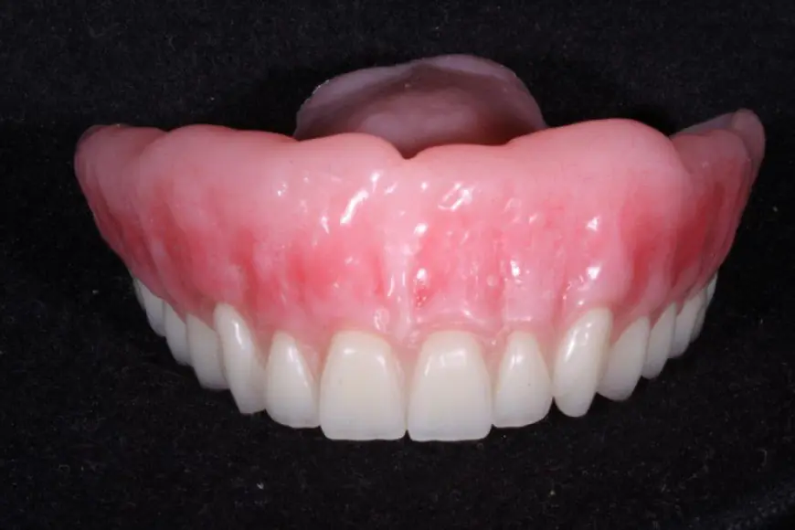 The Pros and Cons of Full vs. Partial Dentures