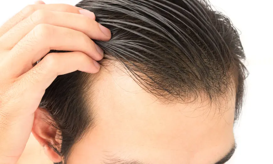 How to Choose the Right Hair Transplant Clinic for Your Needs