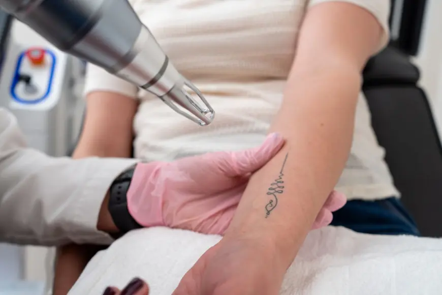 From Black to Bright – Removing All Tattoo Hues with Laser Tattoo Removal!