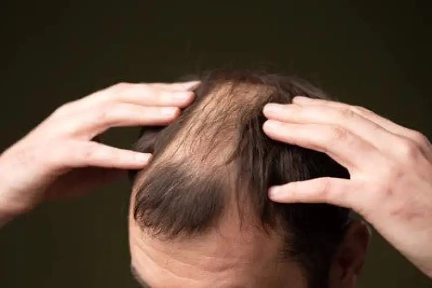 Block DHT, Regrow Hair: The Secret Behind Finasteride’s Success