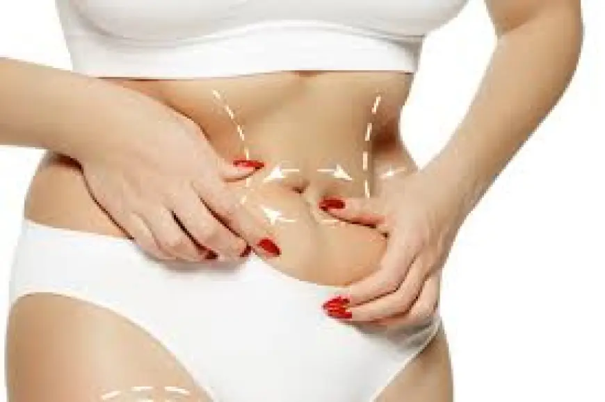 Safe & Effective Tummy Tuck in Dubai – Performed by Experts