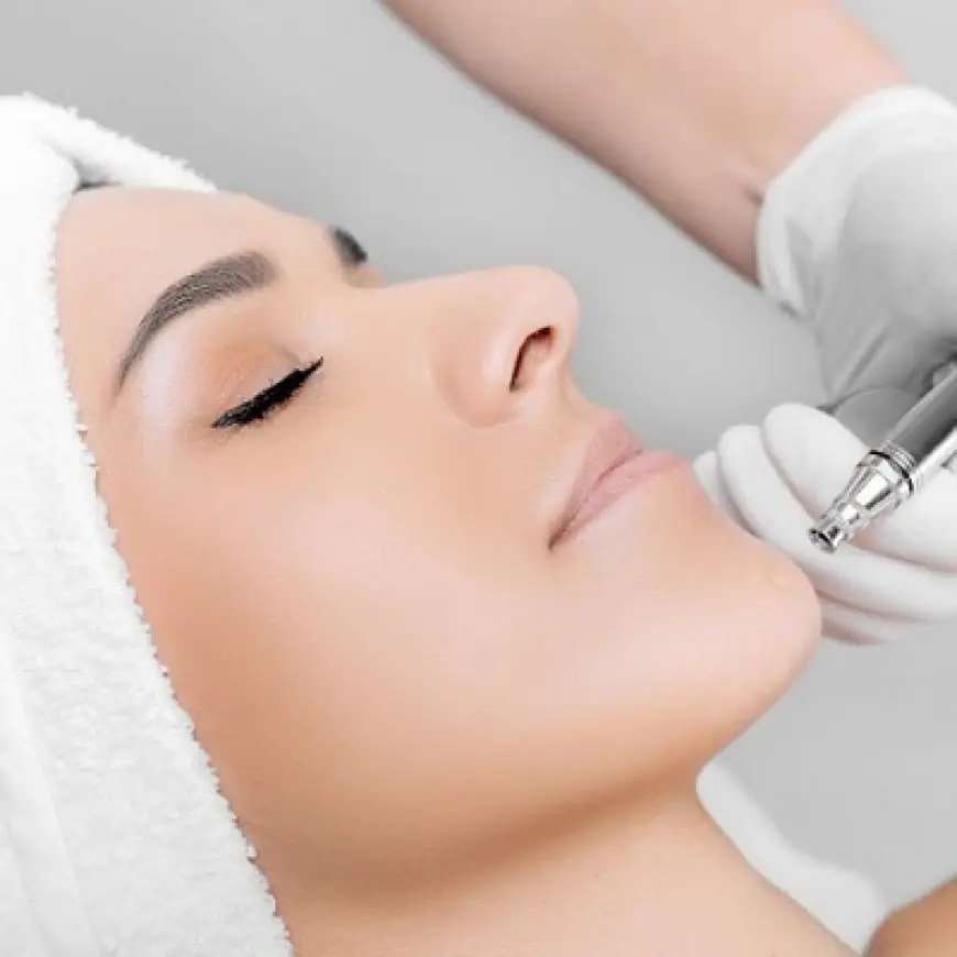 Microdermabrasion Trends in 2025