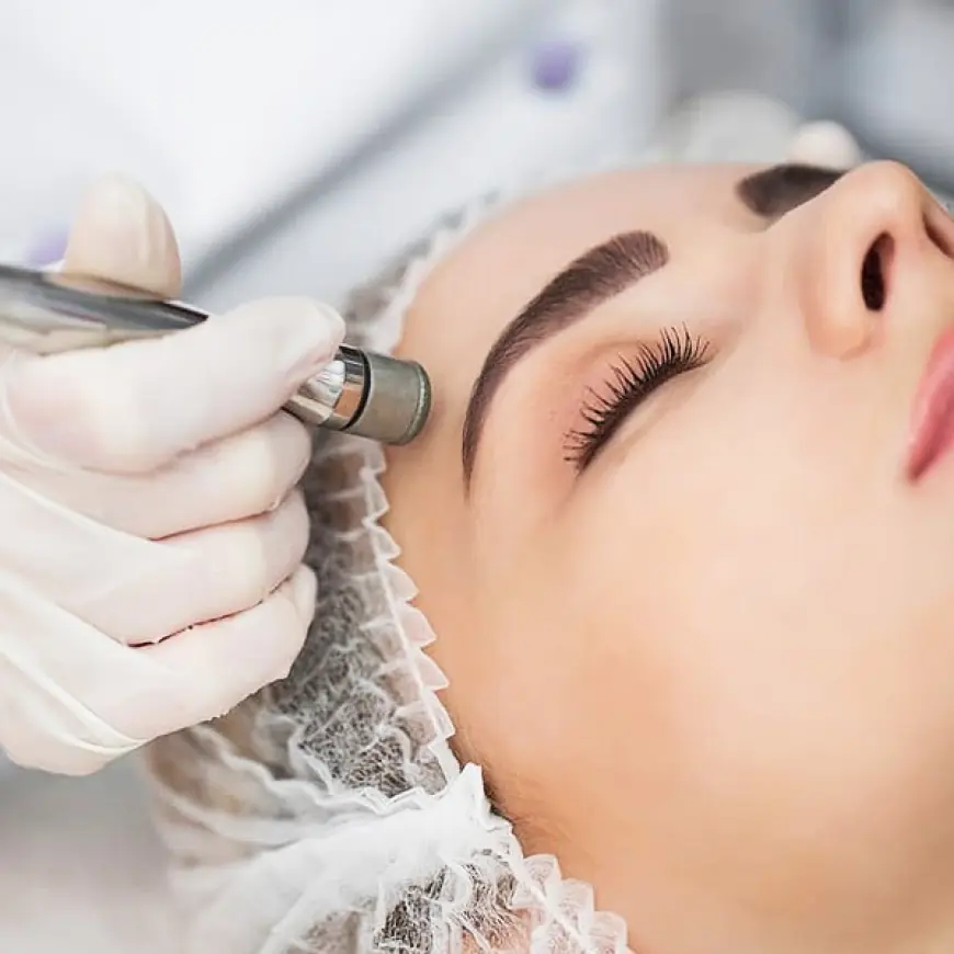 Can Microdermabrasion Treat Enlarged Pores?