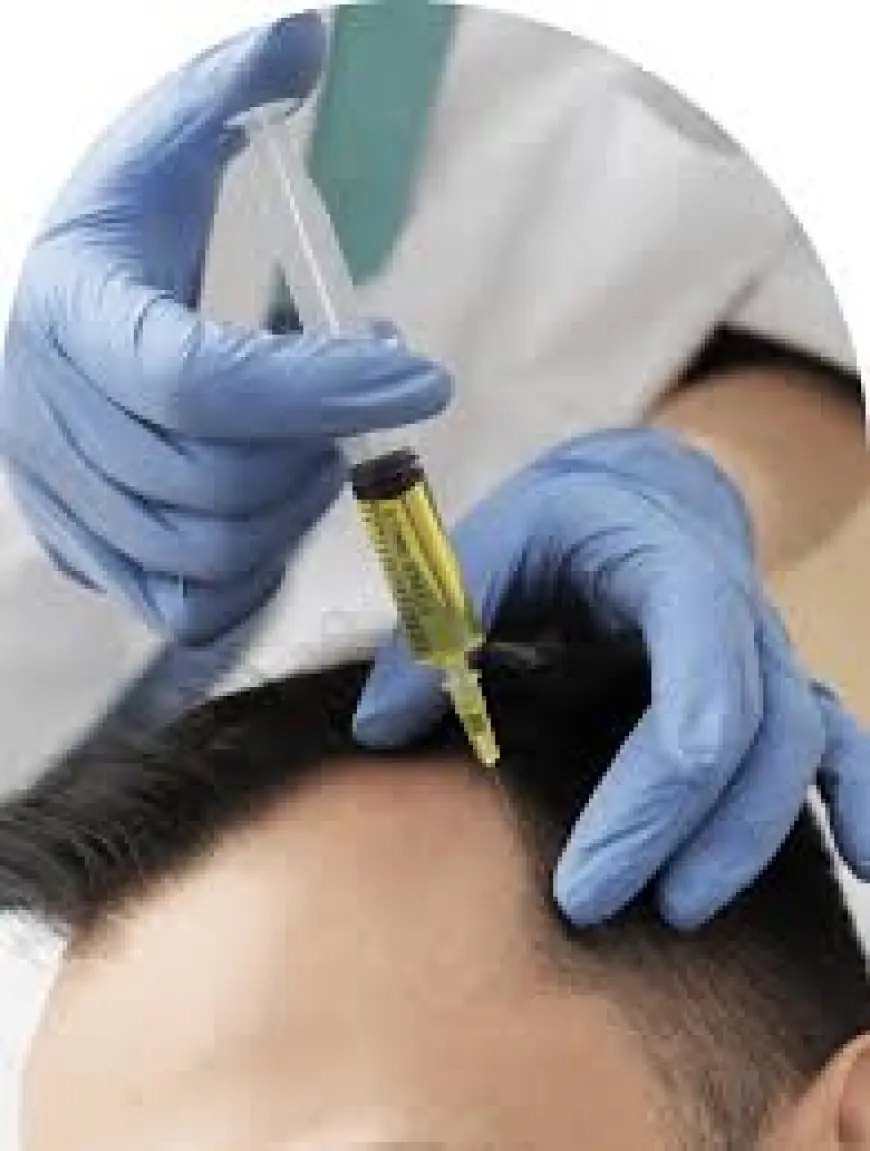 Say Goodbye to Hair Loss – PRP Therapy in Riyadh!