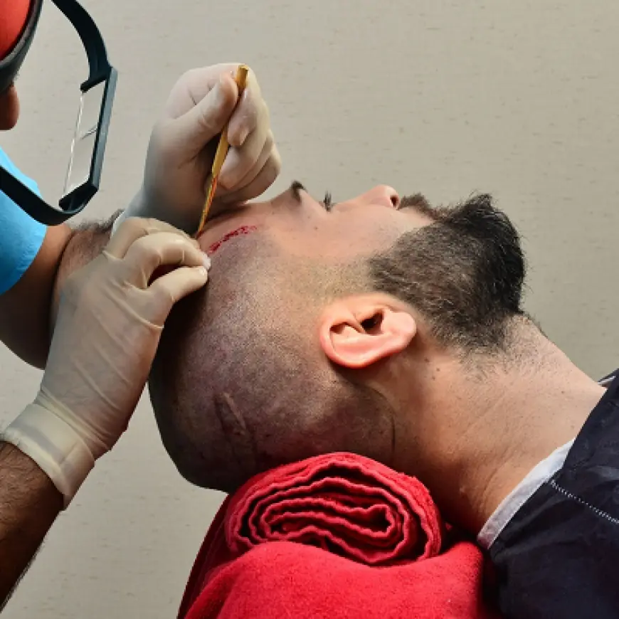 Can a hair transplant fail? What are the reasons?