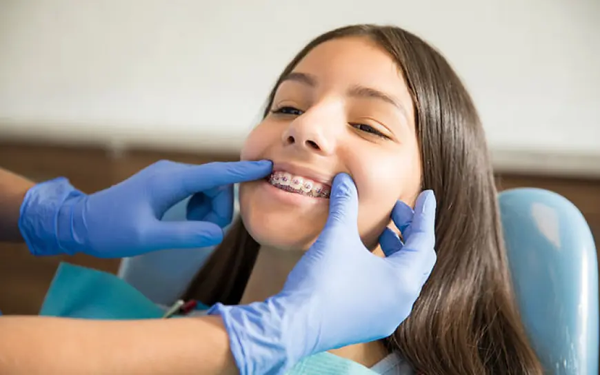 How Orthodontists Create Custom Treatment Plans for Your Unique Smile