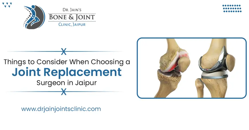 Things to Consider When Choosing for Joint Replacement Surgeon