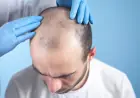 Leading the Way: Want Hair Ltd Enhances FUE Hair Transplant Manchester Care