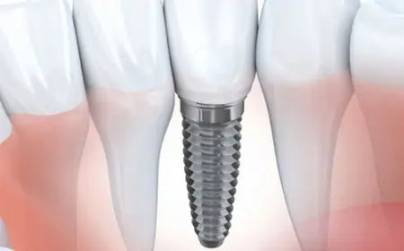 Canberra Smiles Unlocked: The Modern Art of Dental Care