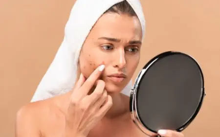 Does Inno Peel Help with Acne Scars?