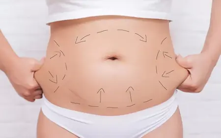 Tummy Tuck Surgery in Islamabad: Complete Overview