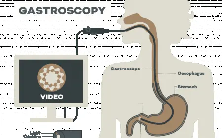 Gastroscopy Singapore Price Explained: Factors That Affect Your Bill