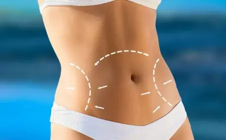Understanding Liposuction: Myths vs. Facts in Islamabad