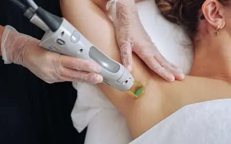 Laser Hair Removal: Get the Best Results Quickly