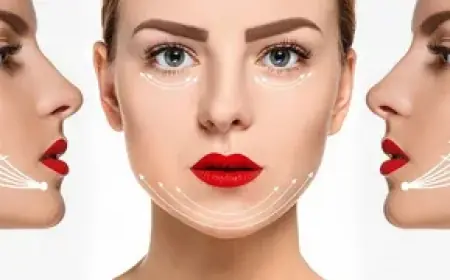 Is the Face Thread Lift Price in Islamabad Worth It?