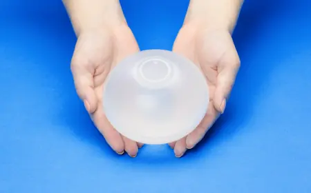 Who is eligible for the Allurion Balloon?