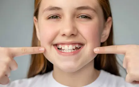 The Pros and Cons of Dental Veneers for Overlapping Teeth