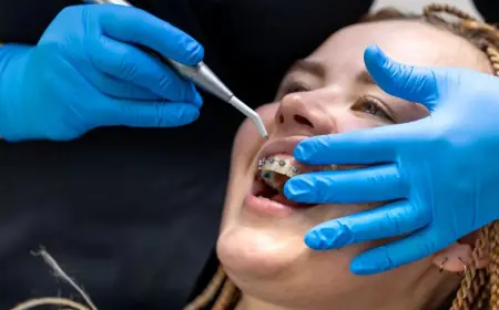 How to Adjust to Wearing a Dental Retainer Comfortably