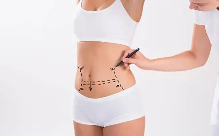 Tummy Tuck Consultation Questions: Your Guide to a Confident Decision