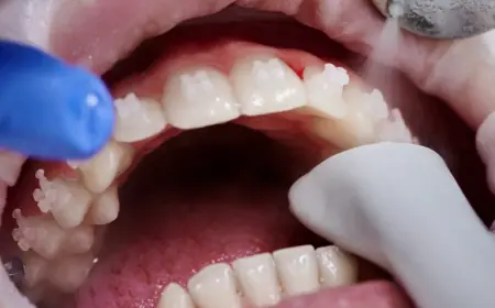 Common Myths About Teeth Polishing and Scaling Debunked