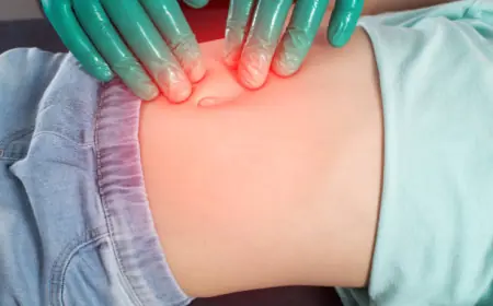 جراحة الفتق في الرياض: هل تحتاج إلى الجراحة أم العلاج الطبيعي؟