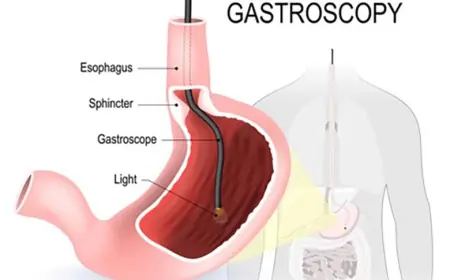 Preparing for a Gastroscopy in Singapore: Diet, Risks & FAQs